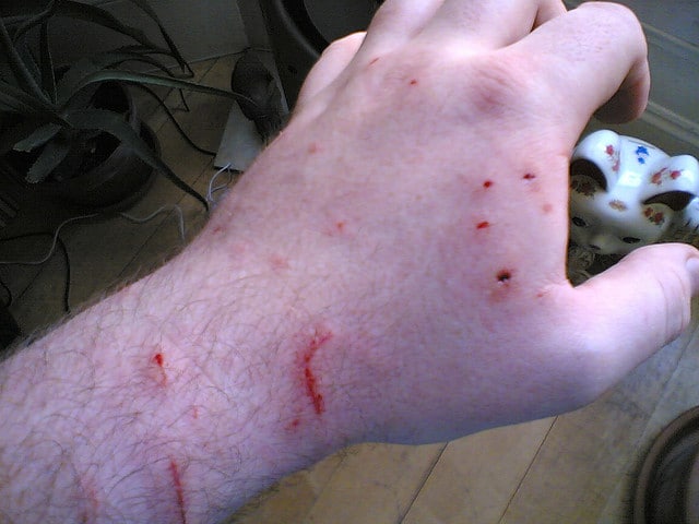 Cat bites on a hand.