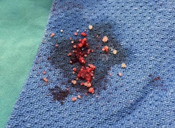 It’s a Pee Thing: Facts About the Feline Bladder - Catster