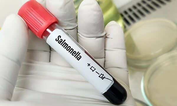 blood sample negative on salmonella