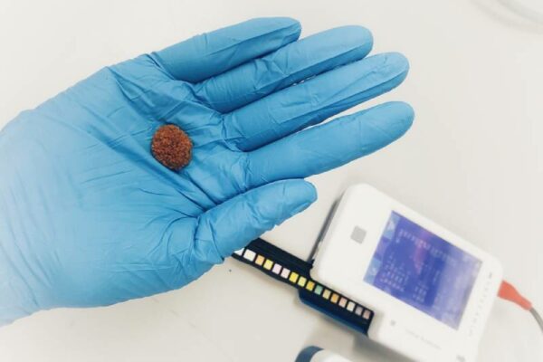 vet holding a pet's kidney stone