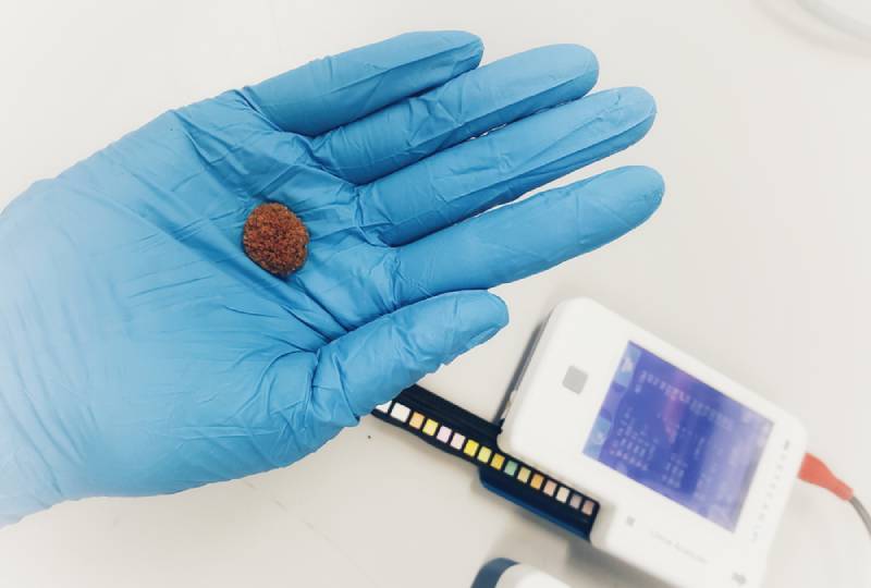 vet holding a pet's kidney stone