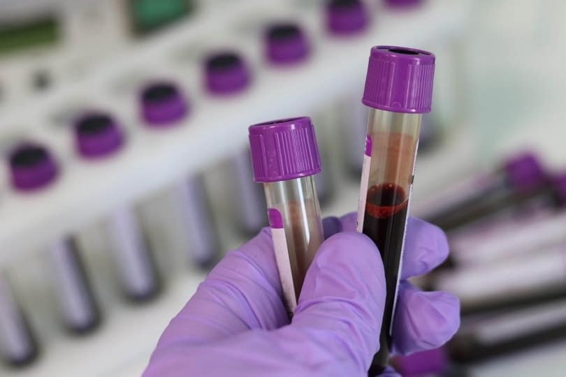 Hand holding blood samples in test tubes