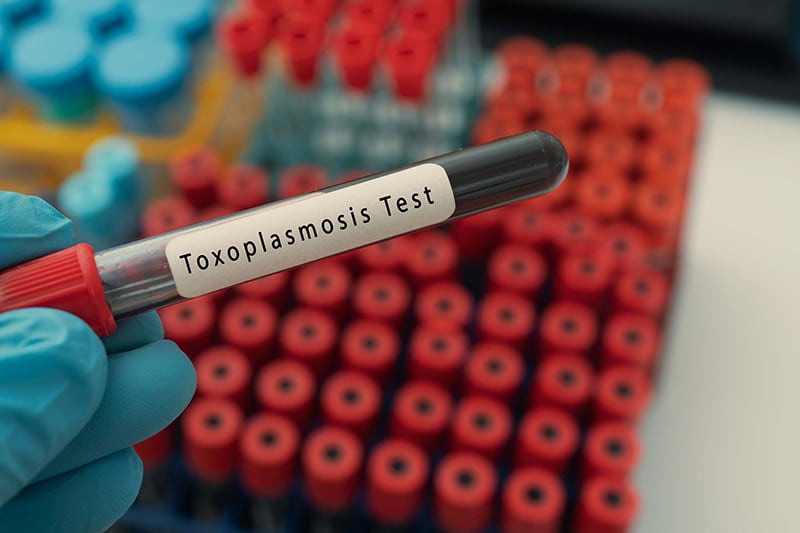 blood sample for toxoplasmosis test