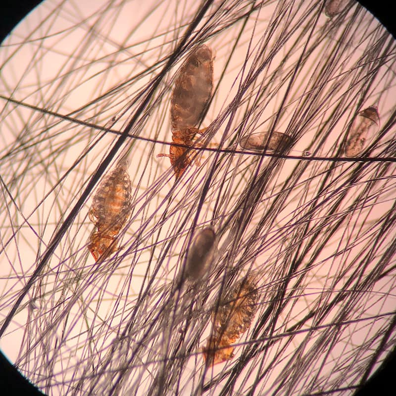 cat lice and egg seen on microscope