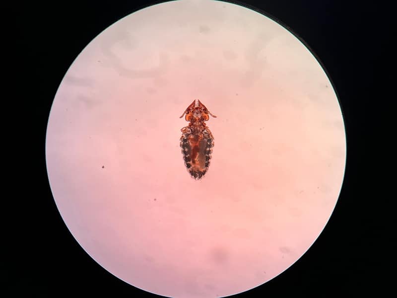 cat lice as seen on microscope