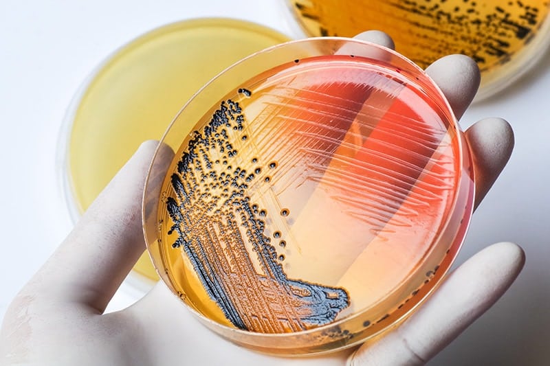 salmonella bacteria growing on petri dish