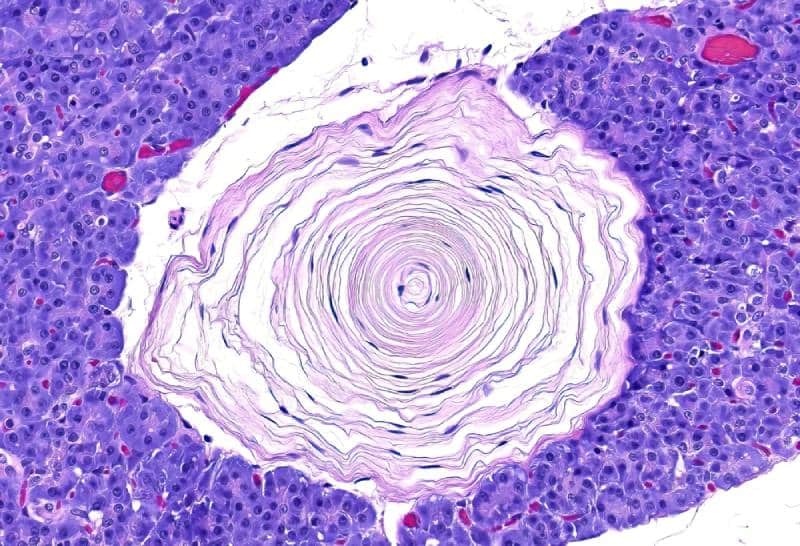 Photomicrograph of feline pancreas