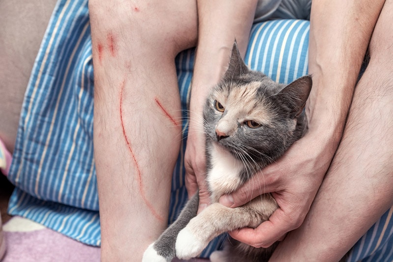scratched wound on a man's leg by a cat