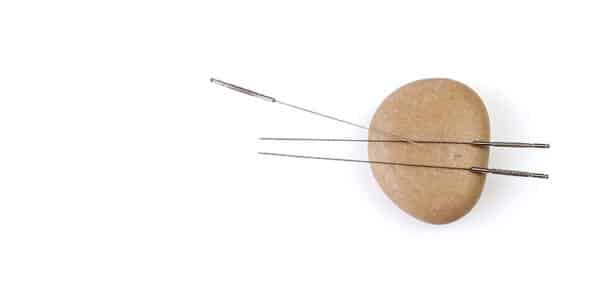 Silver needles for traditional Chinese medicine acupuncture