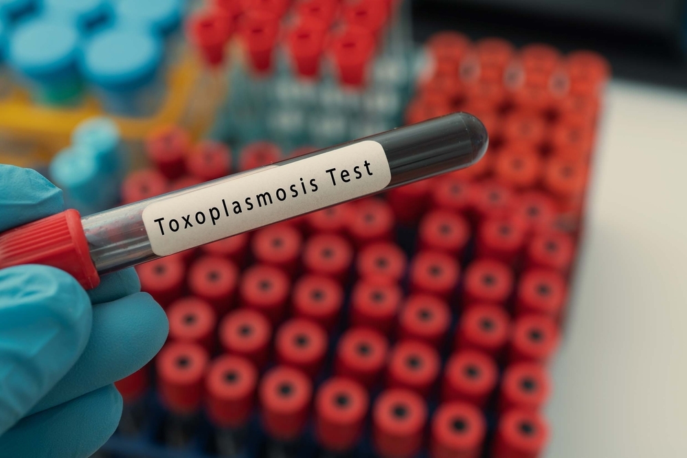 Test tube with blood sample in doctor's hand in laboratory for toxoplasmosis test