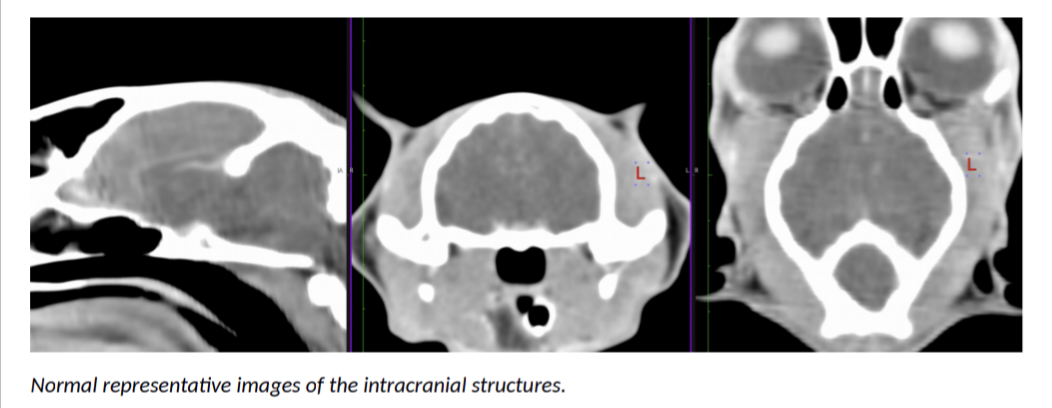 Clutch's normal CT scan